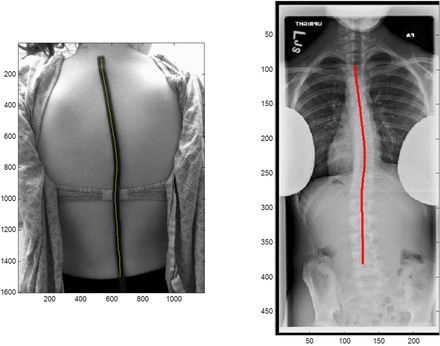 Fig. 11