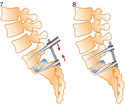 Figures 7 and 8