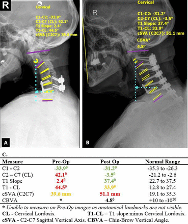 Figure 16