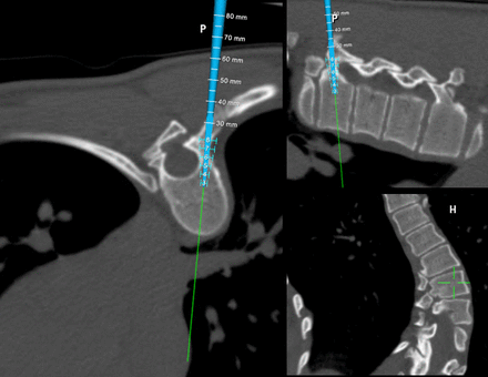 Figure 15