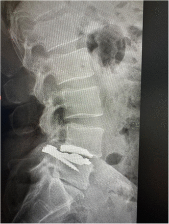 Figure 9