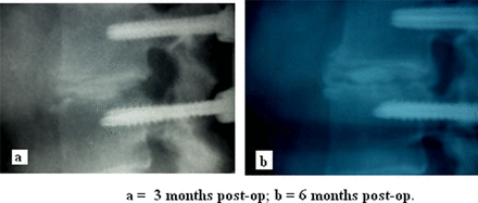 Fig. 16