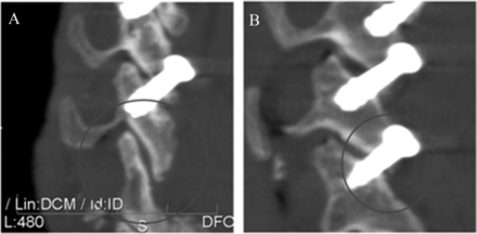 Fig. 11