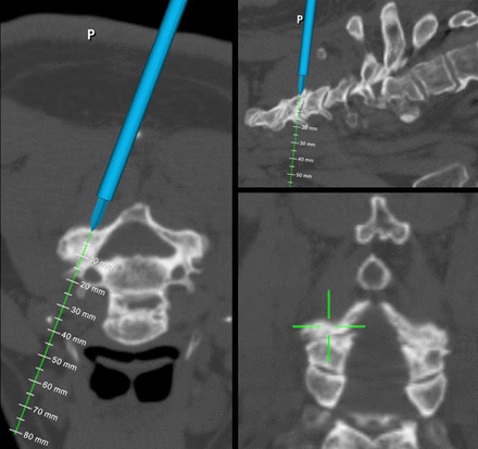 Figure 10