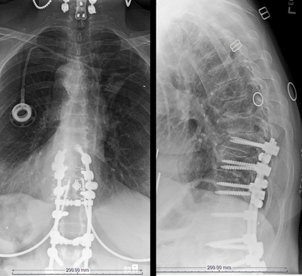 Figure 18