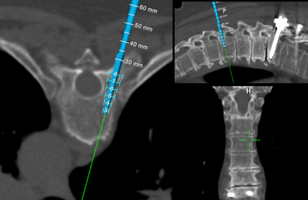 Figure 21