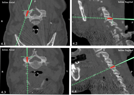 Fig. 4