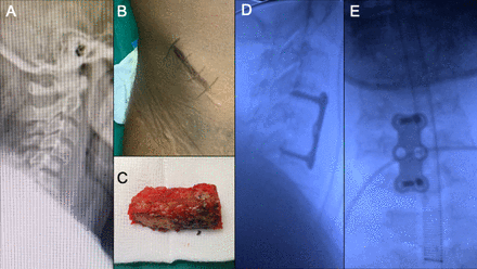 Figure 2A-E