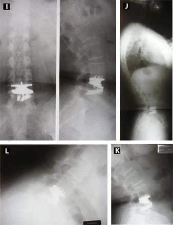 Figures 4I, 4J, 4K, and 4L