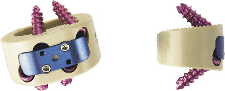 Fig. 1A
