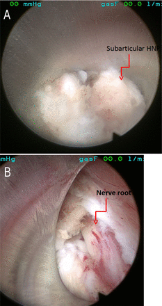 Fig. 9