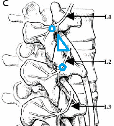 Fig. 9c