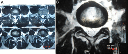 Fig. 13
