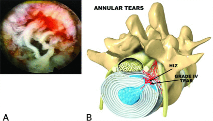 Fig. 17