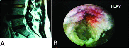 Fig. 20