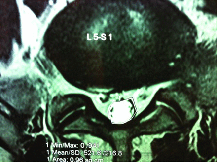 Fig. 21