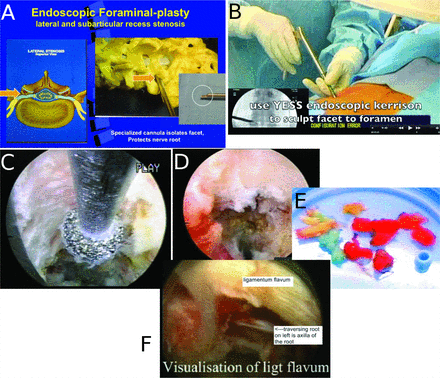 Fig. 23