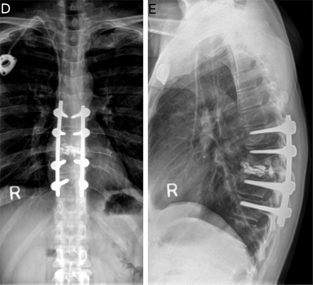 Fig. 1D &1E